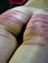 There are marks left on nude teen slave's butt during brutal caning session